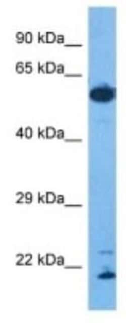 ROD1 Rabbit anti-Human, Polyclonal, Novus Biologicals 100 &mu;g; Unconjugated:Antibodies,